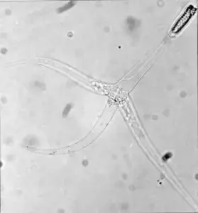 تصویر شماره 29 از گالری کیسه تنان (Cnidaria) چه جانورانی هستند؟