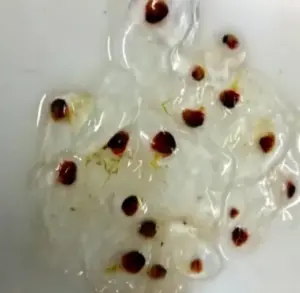 تصویر شماره 11 از گالری کیسه تنان (Cnidaria) چه جانورانی هستند؟